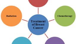 Breast Cancer Treatment Options