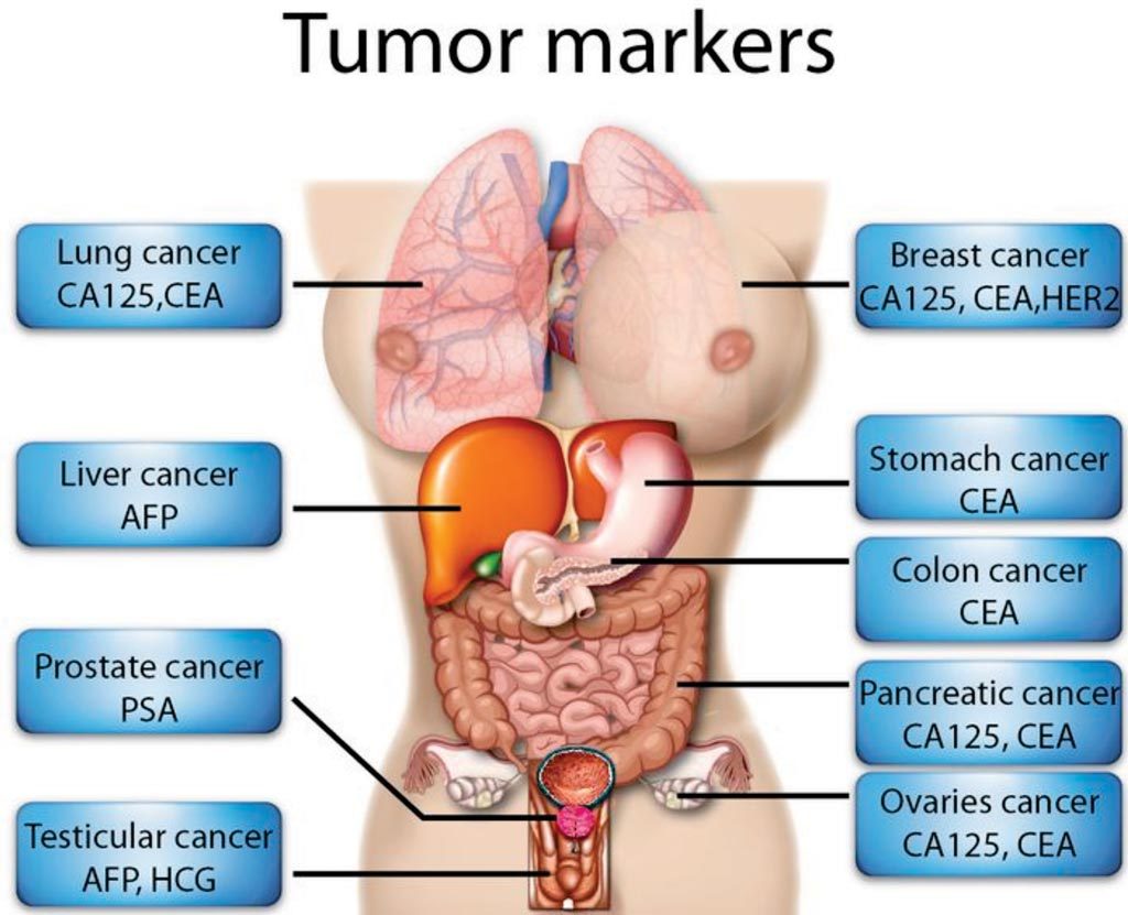 Tumormarker grenzwerte