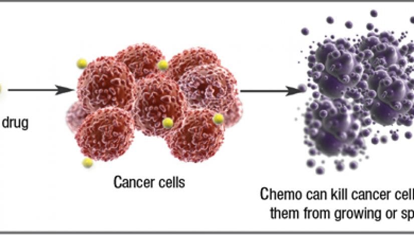 chemotherapy for breast cancer