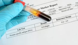 diagnosed with cancer
