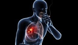 Lung Cancer Treatment in India Positive Bioscience Why don't all smokers get Lung Cancer Treatment