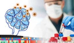 Checkpoint inhibitors biomarker immunotherapy Checkpoint inhibitors biomarker immunotherapy