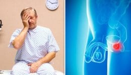 BRCA testing for Prostate Cancer