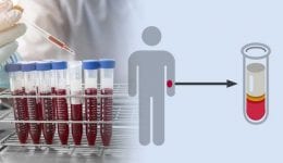 Liquid biopsy: Alternative to Biopsy Test for cancer