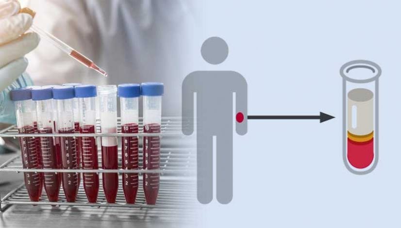 Liquid biopsy: Alternative to Biopsy Test for cancer