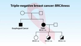 Triple negative Breast cancer