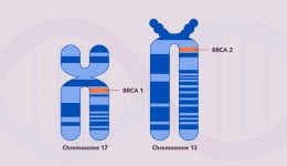 blog-BRCA brca test