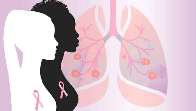 Are breast cancer and lung cancer related