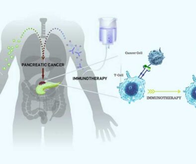 Immunotherapy Pancancer -TMB